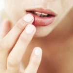 Sariawan Atau Cari Lawan?